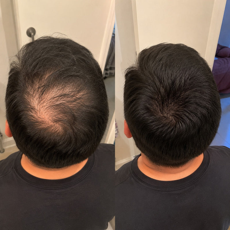 Antes y después — Carlos V., 36