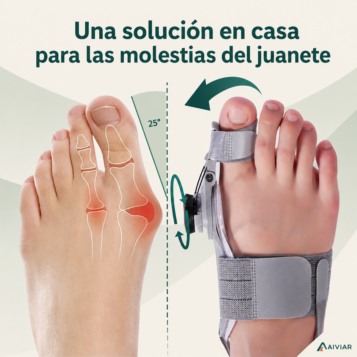 Corrector Articulado para Juanetes ALIVIAR
